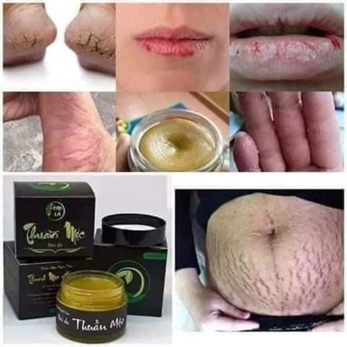 cao-la-thanh-moc-huong-tri-nut-ne